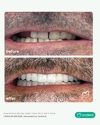 Andent Dental Clinic